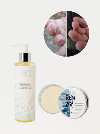 Kuivien käsien hoito