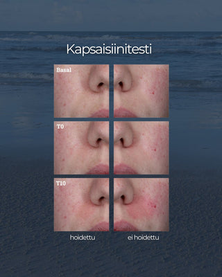 24H Kasvovoide herkälle iholle, pitkäkestoinen kosteutus, tukee ihon suojamuuria, rauhoittaa, hajusteeton, UNISEX kapsaisiinitesti