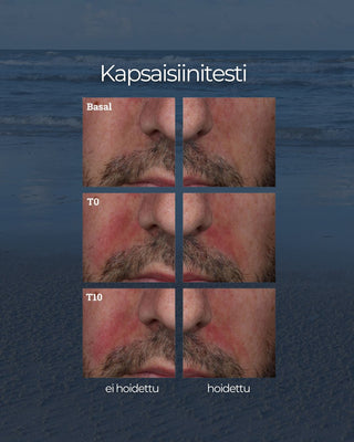 24H Kasvovoide herkälle iholle, pitkäkestoinen kosteutus, tukee ihon suojamuuria, rauhoittaa, hajusteeton, UNISEX kapsaisiinitesti