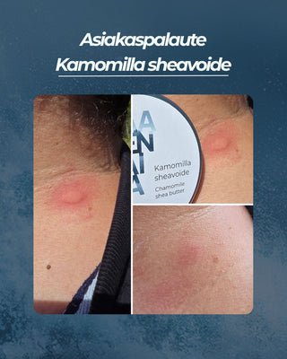 Asiakaspalaute
Kamomilla sheavoide Paarmanpuremat