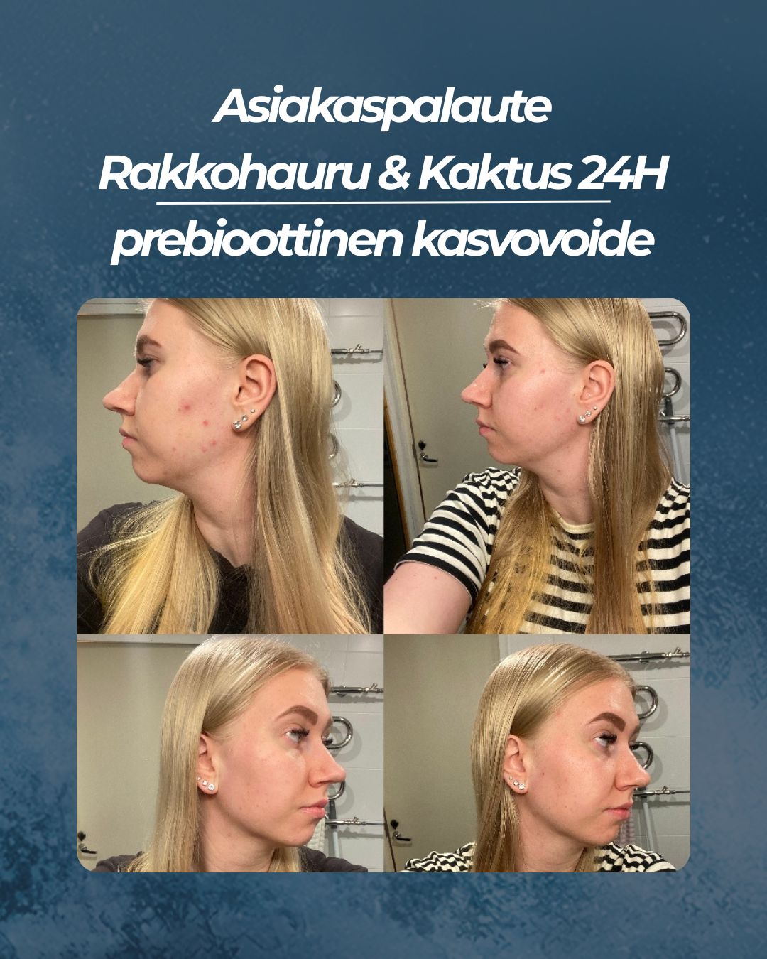 Asiakaspalaute
Rakkohauru & Kaktus 24H prebioottinen kasvovoide