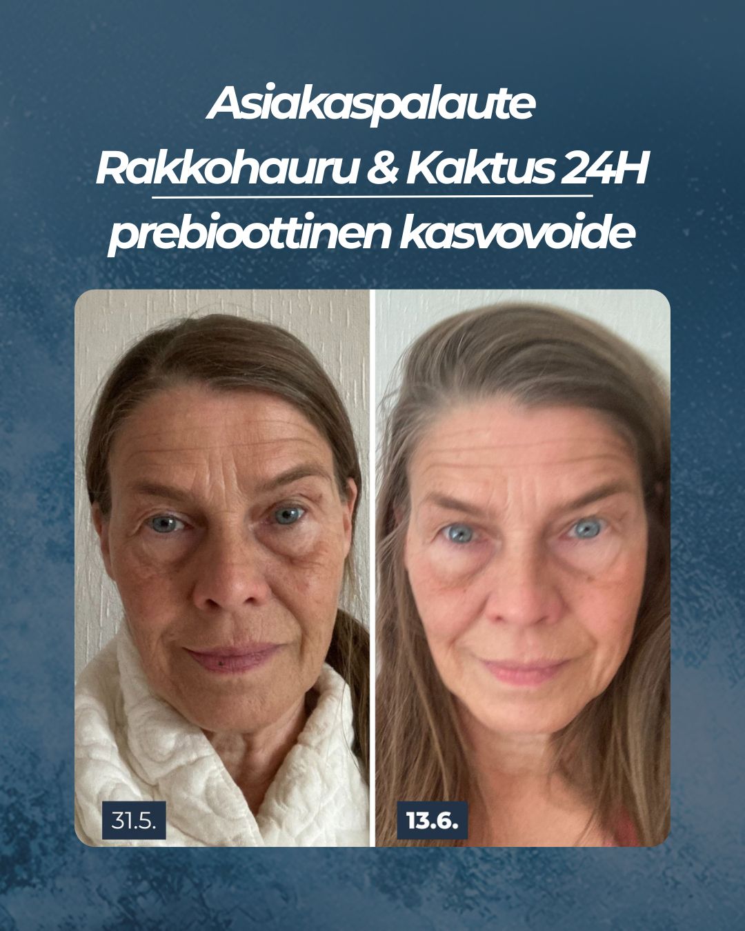 Asiakaspalaute
Rakkohauru & Kaktus 24H prebioottinen kasvovoide
