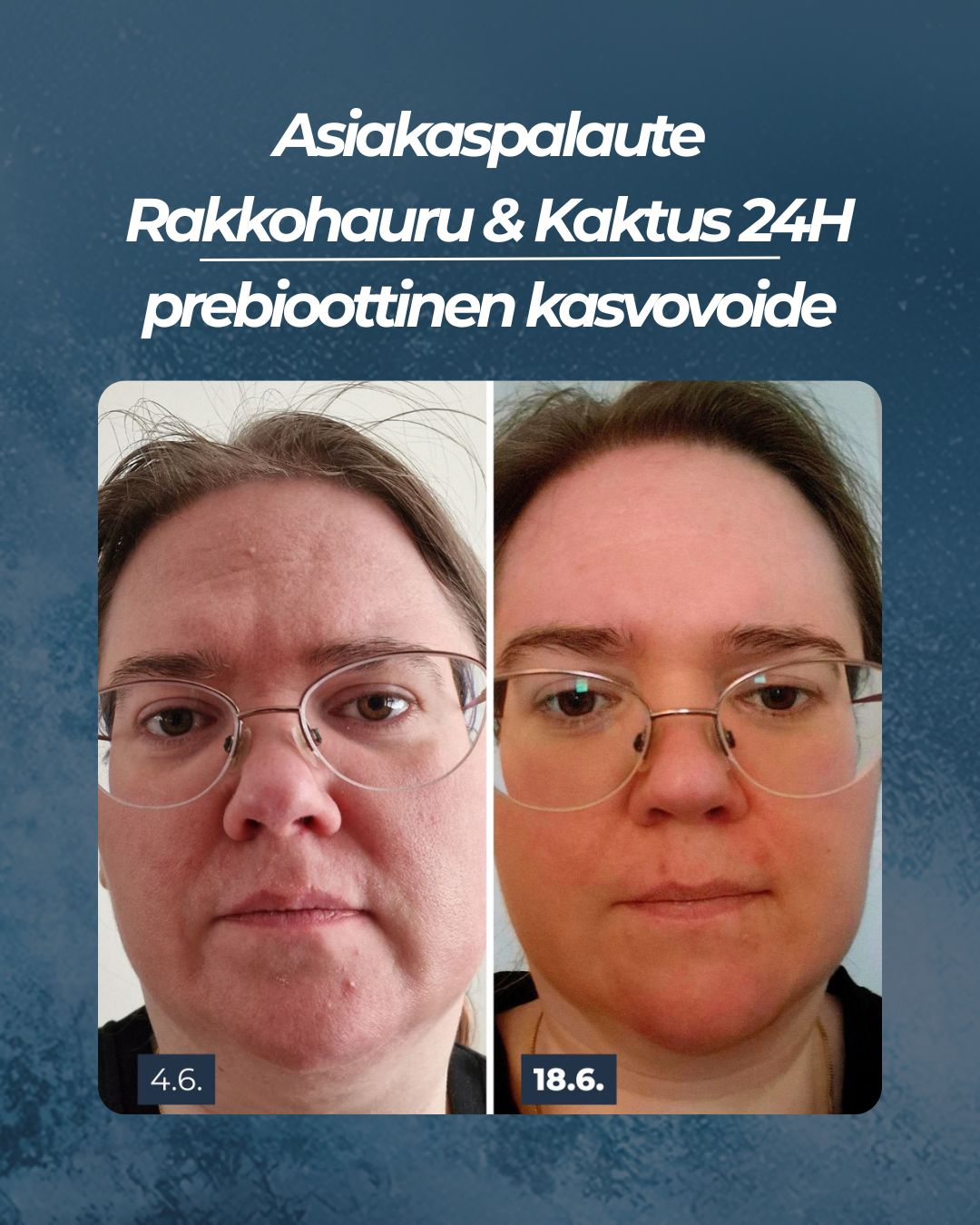 Asiakaspalaute
Rakkohauru & Kaktus 24H prebioottinen kasvovoide