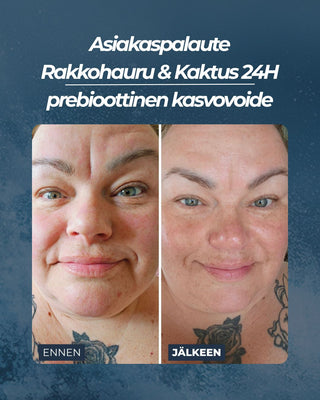 Asiakaspalaute Rakkohauru & Kaktus 24H prebioottinen kasvovoide