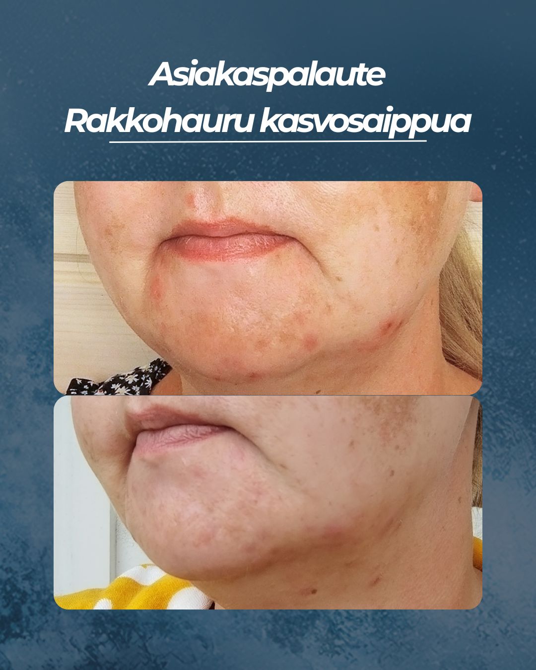 Asiakaspalaute Rakkohauru kasvosaippua
