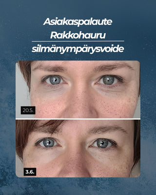 Asiakaspalaute Rakkohauru silmänympärysvoide