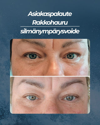 Asiakaspalaute Rakkohauru silmänympärysvoide