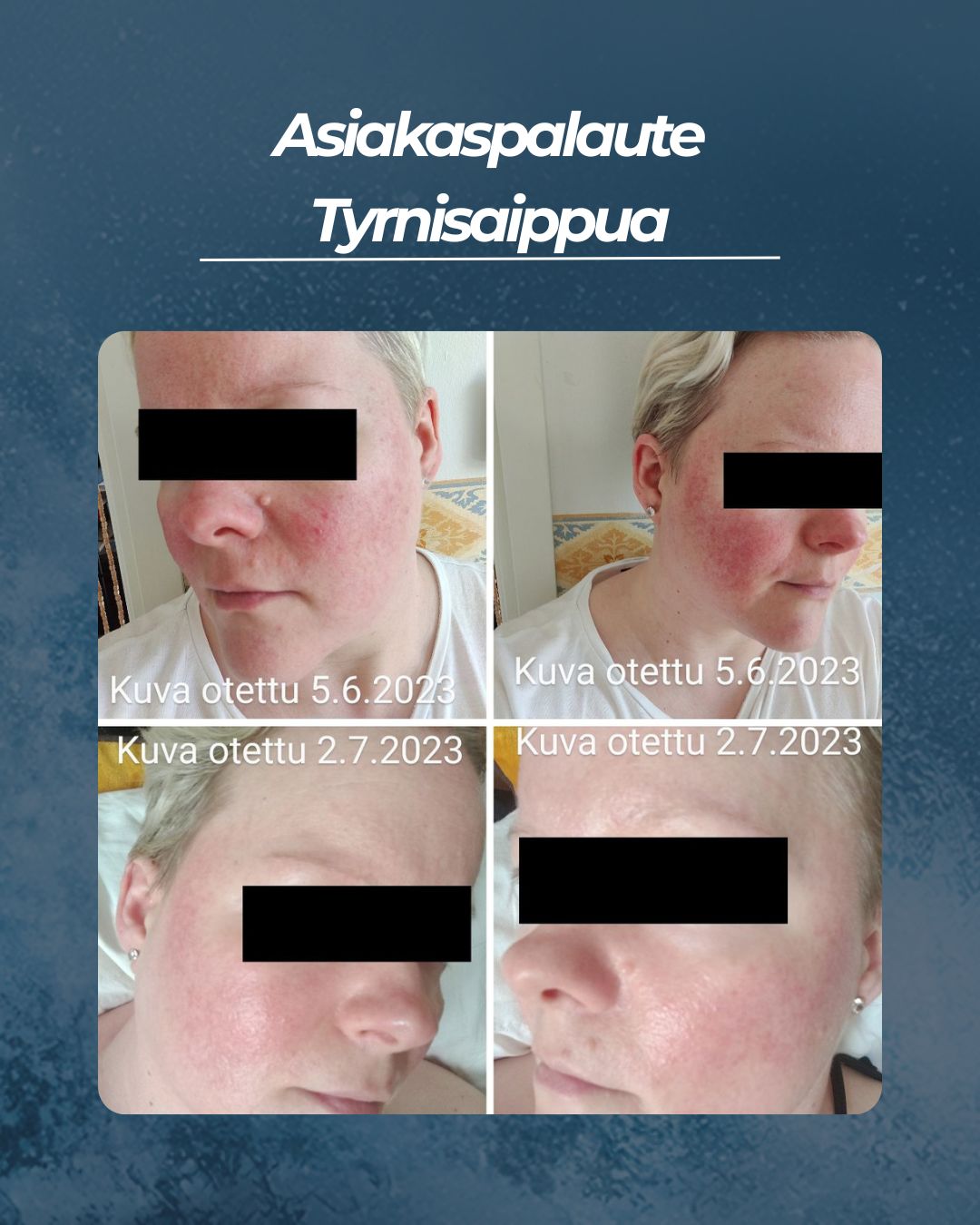 Asiakaspalaute Tyrnisaippua