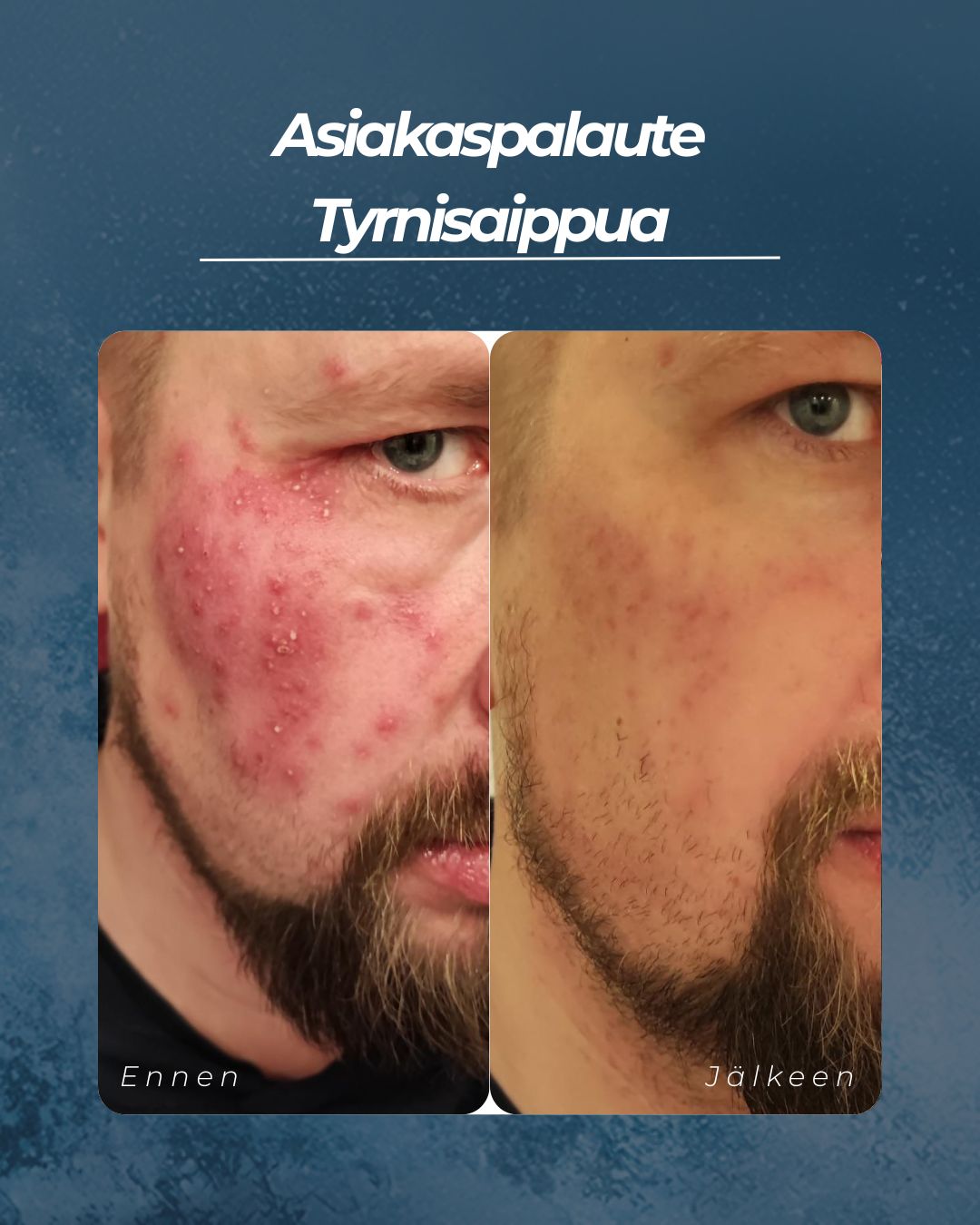 Asiakaspalaute Tyrnisaippua