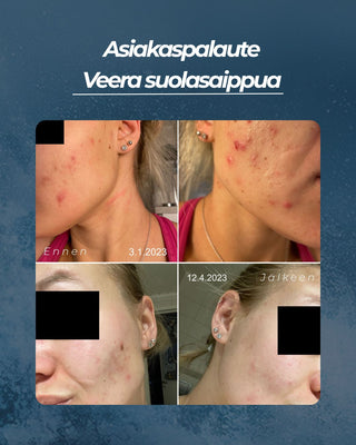 Asiakaspalaute
Veera suolasaippua