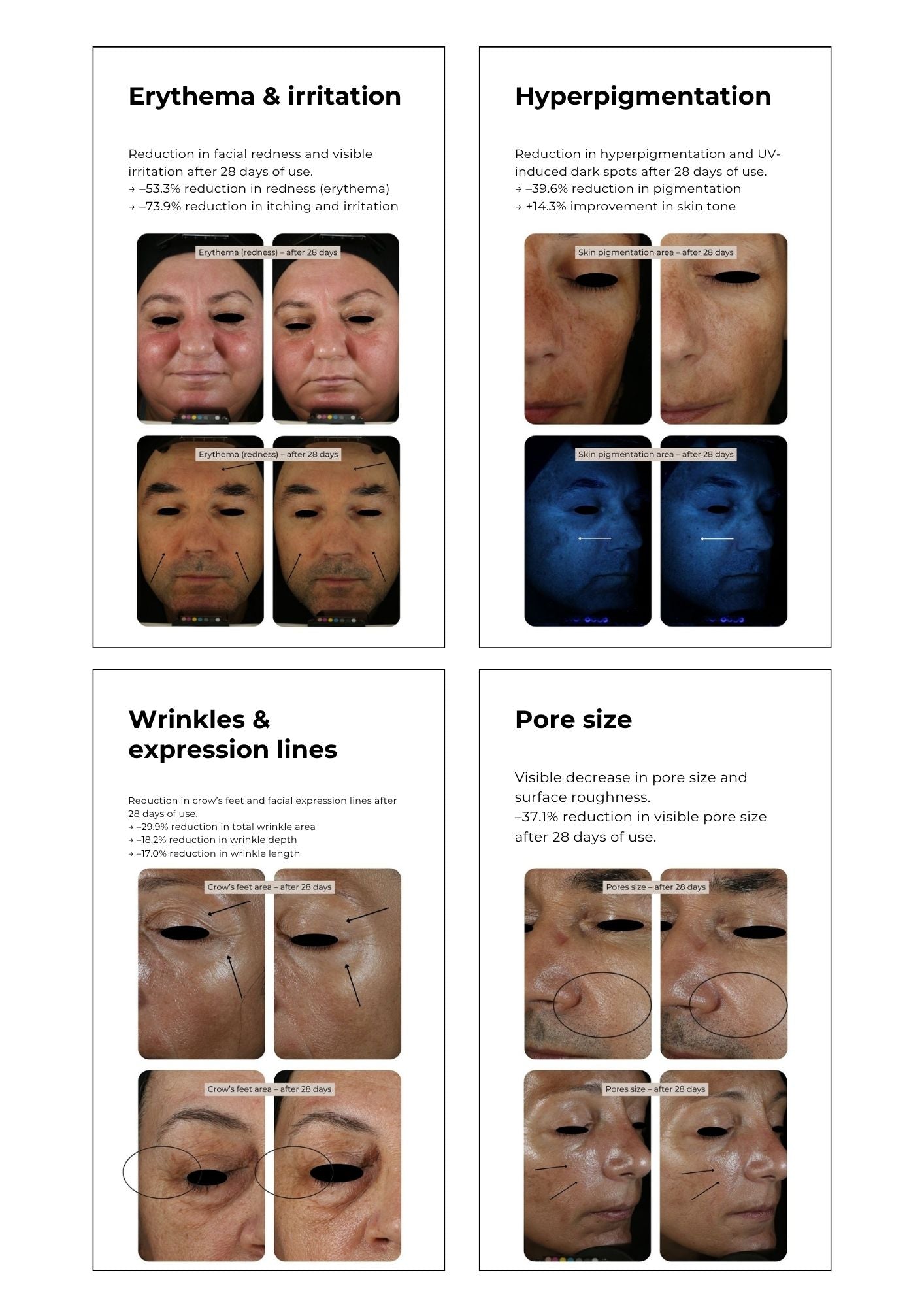 Rakkohauru superseerumi, peptidit, retinoli, hyaluronihappo, maksaläiskät, juonteet, ihohuokoset Kasvoseerumi Saaren Taika