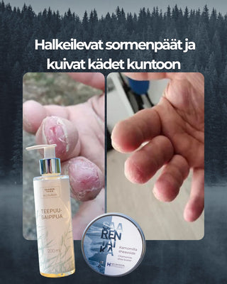 Halkeilevat sormenpäät ja kuivat kädet kuntoon nopeasti tuotesetti, sisältää Teepuusaippuan ja Kamomilla sheavoiteen