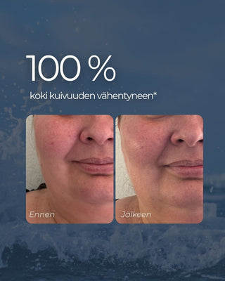 Hyaluronihapposeerumi, hajusteeton tehokosteuttaja kuivalle ja herkälle iholle
