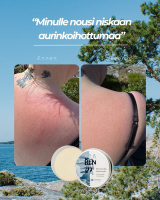 Rauhoita auringosta ärtynyt iho setti, sis. ärtynyttä ja kutisevaa ihoa rauhoittava Kamomilla sheavoide sekä Veera suolasaippua