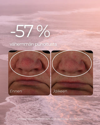 Punoitusta rauhoittava suojamuuria vahvistava seerumi, hajusteeton, vegaaninen, 98,6% luonnollista