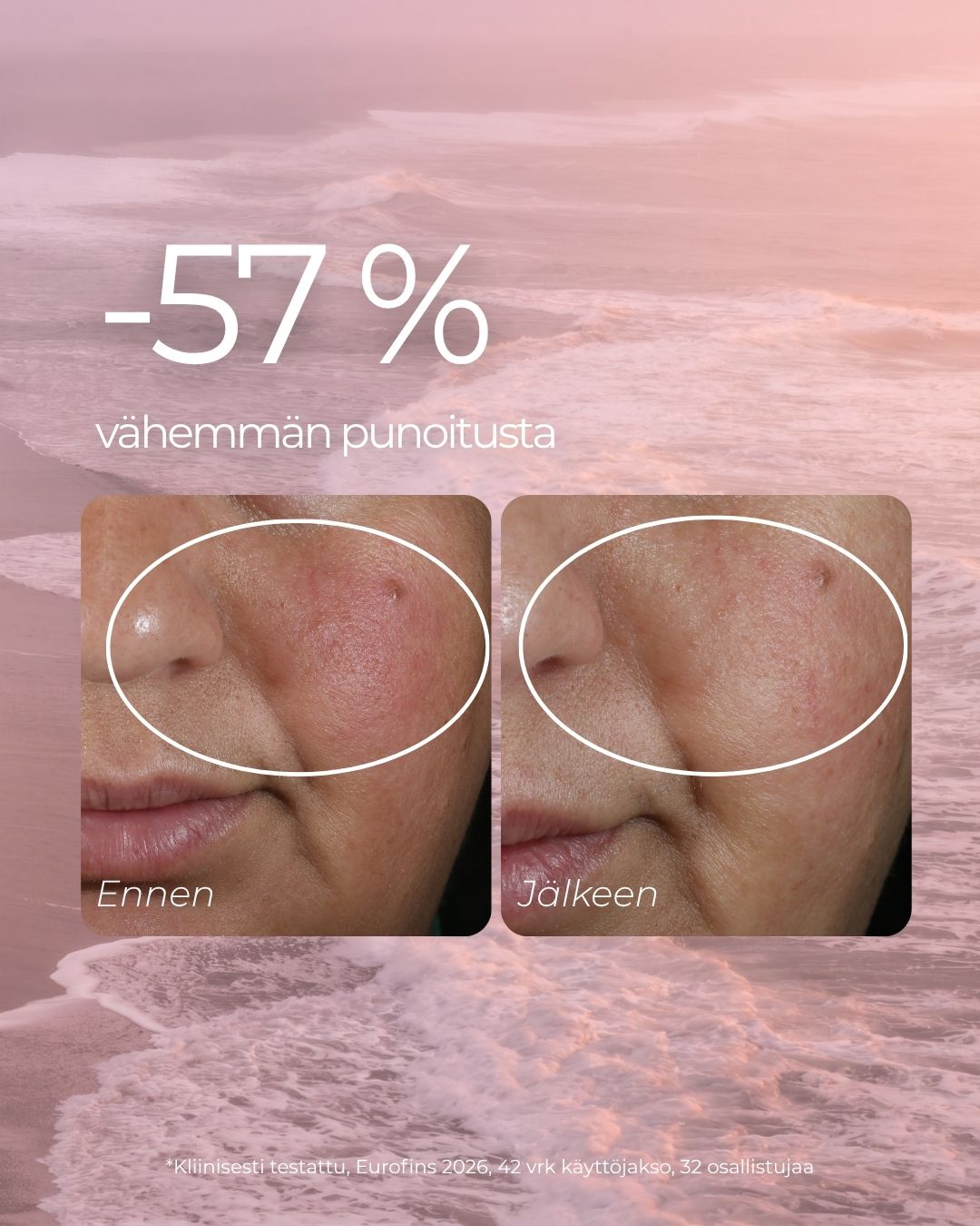 Punoitusta rauhoittava suojamuuria vahvistava seerumi ruusufinniin ja couperosaan taipuvalle iholle, hajusteeton, vegaaninen