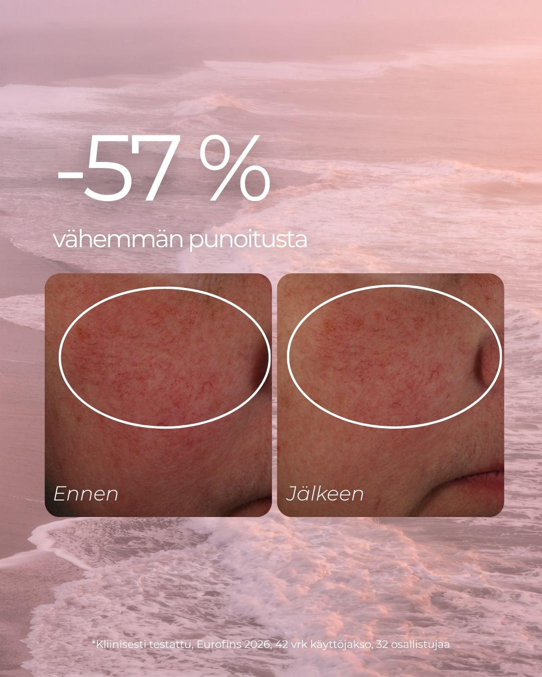 Punoitusta rauhoittava suojamuuria vahvistava seerumi ruusufinniin ja couperosaan taipuvalle iholle, hajusteeton, vegaaninen