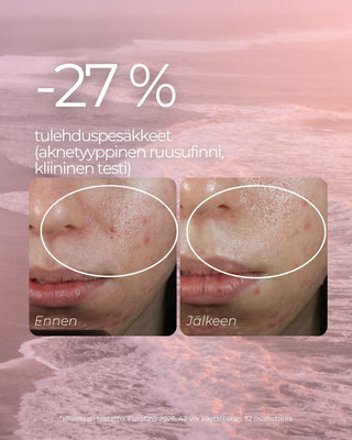Punoitusta rauhoittava suojamuuria vahvistava seerumi, hajusteeton, vegaaninen, 98,6% luonnollista