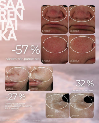 Punoitusta rauhoittava suojamuuria vahvistava seerumi on kehitetty ruusufinniin taipuvaiselle ja reagoivalle iholle. Se on kliinisesti testattu, ja dermatologin valvomassa tutkimuksessa punoitus väheni 57 % 42 vuorokauden käytön jälkeen, ja myös kuumotuksen, kirvelyn ja kireyden tunne helpotti merkitsevästi.