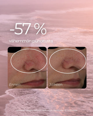 Punoitusta rauhoittavan suojamuuria vahvistavan seerumin kliinisen tutkimuksen tulos. -57 % vähemmän punoitusta.