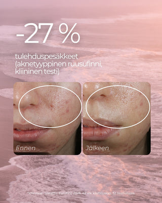 Punoitusta rauhoittavan suojamuuria vahvistavan seerumin kliinisen tutkimuksen tulos. -27 % vähemmän tulehduspesäkkeitä.