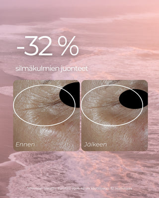 Punoitusta rauhoittavan suojamuuria vahvistavan seerumin kliinisen tutkimuksen tulos. -32 % silmäkulmien juonteet.
