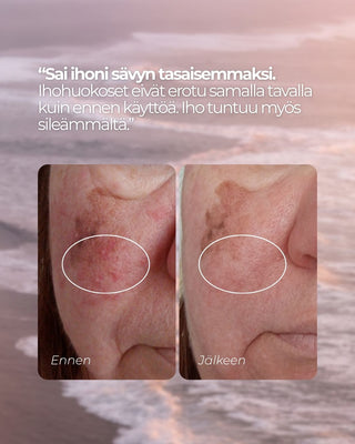 Punoitusta rauhoittava 24H kasvovoide, hajusteeton, vegaaninen, 98,86% luonnollista asiakaspalaute
