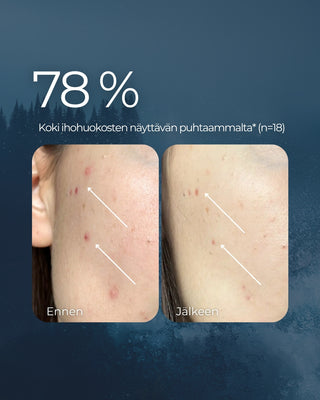 Bladderwrack Salicylic Acid facial toner, for blemished and easily oily skin