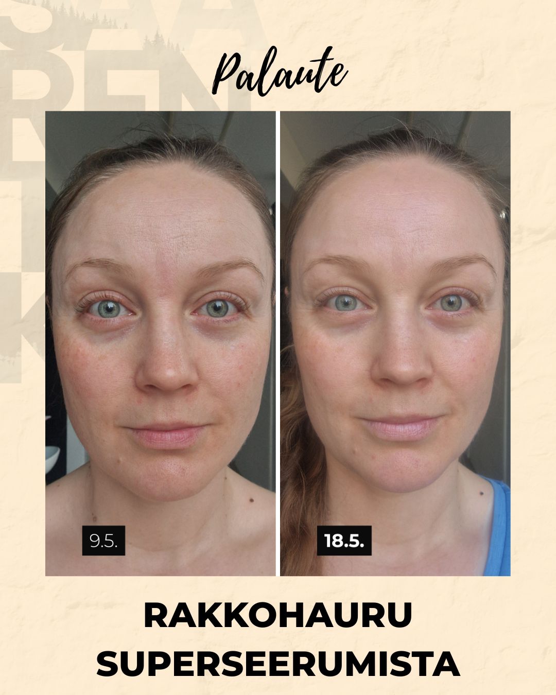 Rakkohauru superseerumi, peptidit, retinoli, hyaluronihappo, maksaläiskät, juonteet, ihohuokoset Kasvoseerumi Saaren Taika