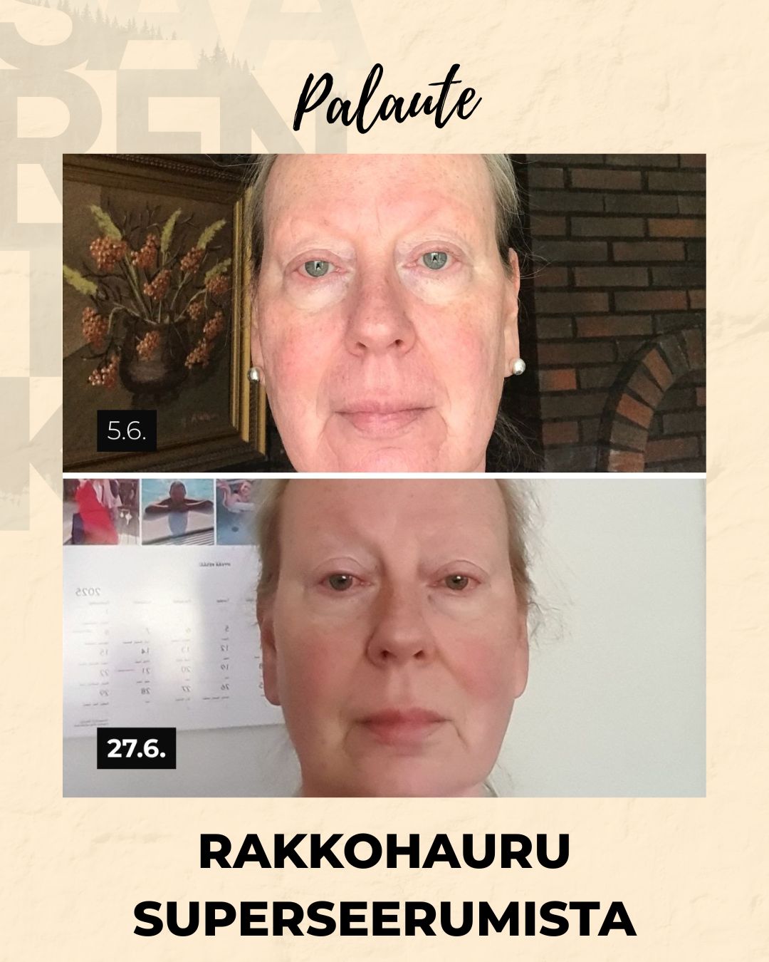 Rakkohauru superseerumi, peptidit, retinoli, hyaluronihappo, maksaläiskät, juonteet, ihohuokoset Kasvoseerumi Saaren Taika