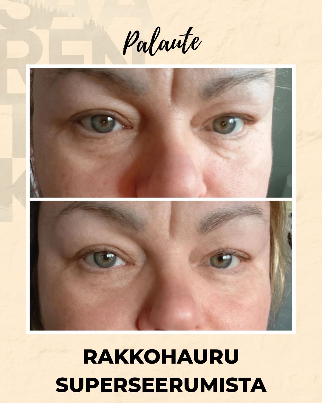 Rakkohauru superseerumi, peptidit, retinoli, hyaluronihappo, maksaläiskät, juonteet, ihohuokoset Kasvoseerumi Saaren Taika