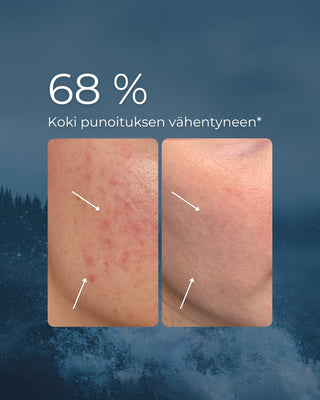 Blåstång & Jojoba ansiktsolja för irriterad, röd och oren hy, vegansk, 100 % naturlig
