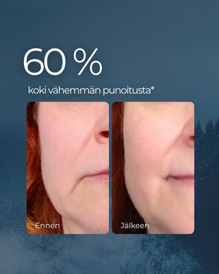 Rakkohauru & Kaktus 24H prebioottinen kasvovoide herkälle iholle