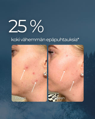 Rakkohauru & Kaktus 24H prebioottinen kasvovoide herkälle iholle