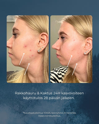 Rakkohauru & Kaktus 24H prebioottinen kasvovoide herkälle iholle