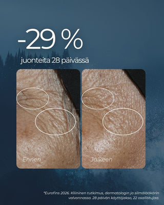 Rakkohauru silmänympärysvoide vähentää 29% juonteita 28 päiväss