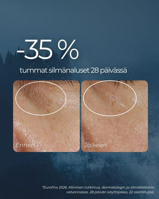 Rakkohauru silmänympärysvoide vähentää 35% tummia silmänalusia 28 päivässä