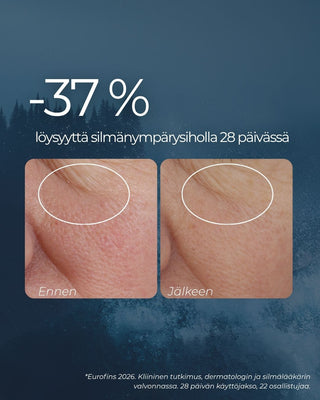 Rakkohauru silmänympärysvoide vähentää turvotusta 37 % 28 päivässä