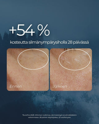 Rakkohauru silmänympärysvoide parantaa ihon kosteutta 54 % 28 päivässä