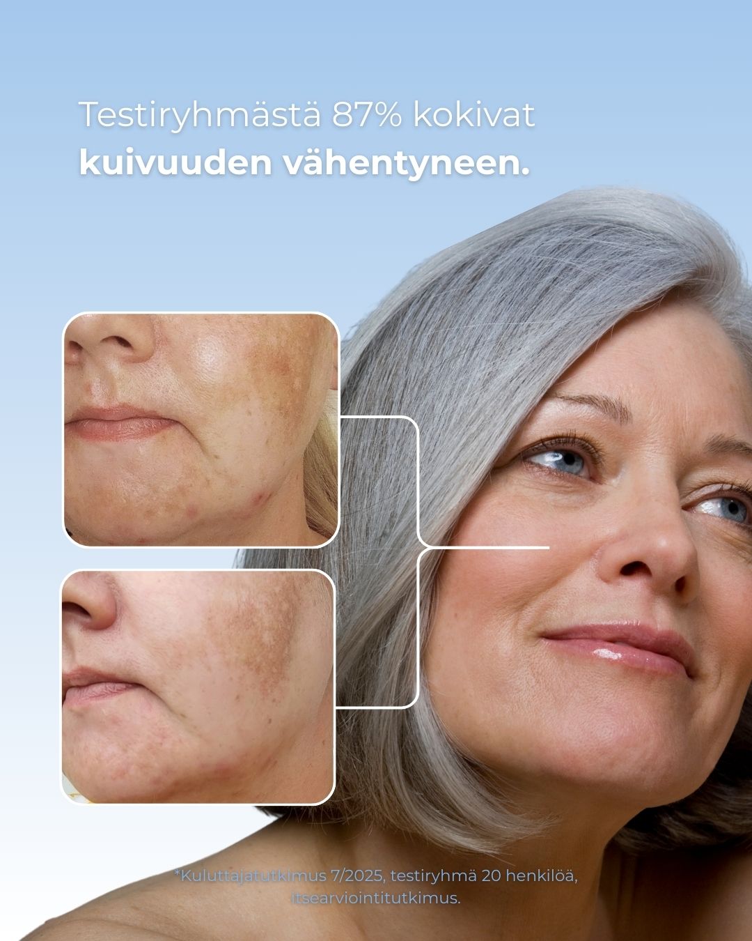 Luonnollinen Rakkohauru kasvosaippualla on antibakteerisia ominaisuuksia, joiden avulla se voi hillitä ihon kutinaa ja epäpuhtauksien syntymistä.