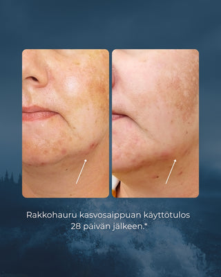 Rakkohauru kasvosaippua | Luonnollista ihonhoitoa mikrobiomin tueksi