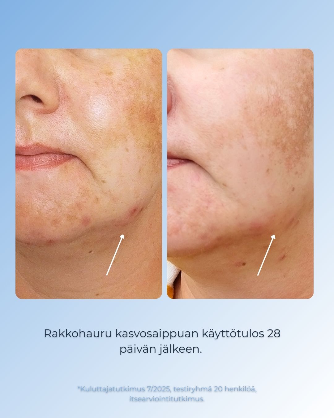 Luonnollinen Rakkohauru kasvosaippua on erinomainen valinta kuivan ja kutiavan ihon päivittäiseen puhdistukseen