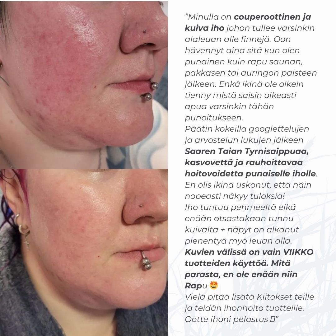 Ruusufinni iholle Sopiva Punoittavan Ihon Hoitosetti Saaren Taika Shop Ruusufinni iholle Sopiva Punoittavan Ihon Hoitosetti Saaren Taika Shop
