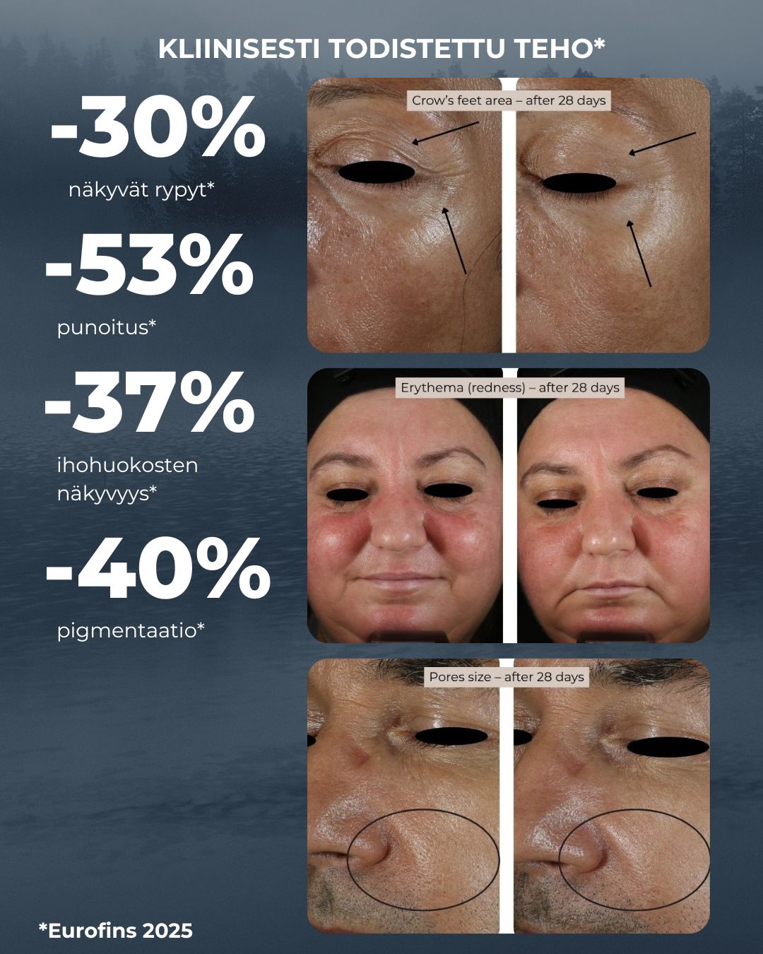 Saaren Taika Rakkohauru Superseerumi testattiin kliinisessä tutkimuksessa dermatologin valvonnassa