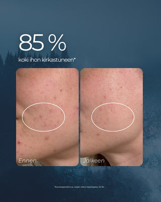 Syväpuhdistava Aktiivihiili Savi kasvonaamio, puhdistaa ihohuokoset ja vähentää mustapäitä kuivattamatta ihoasi, rasvoittuvalle ja akneen taipuvalle iholle kuvapalaute