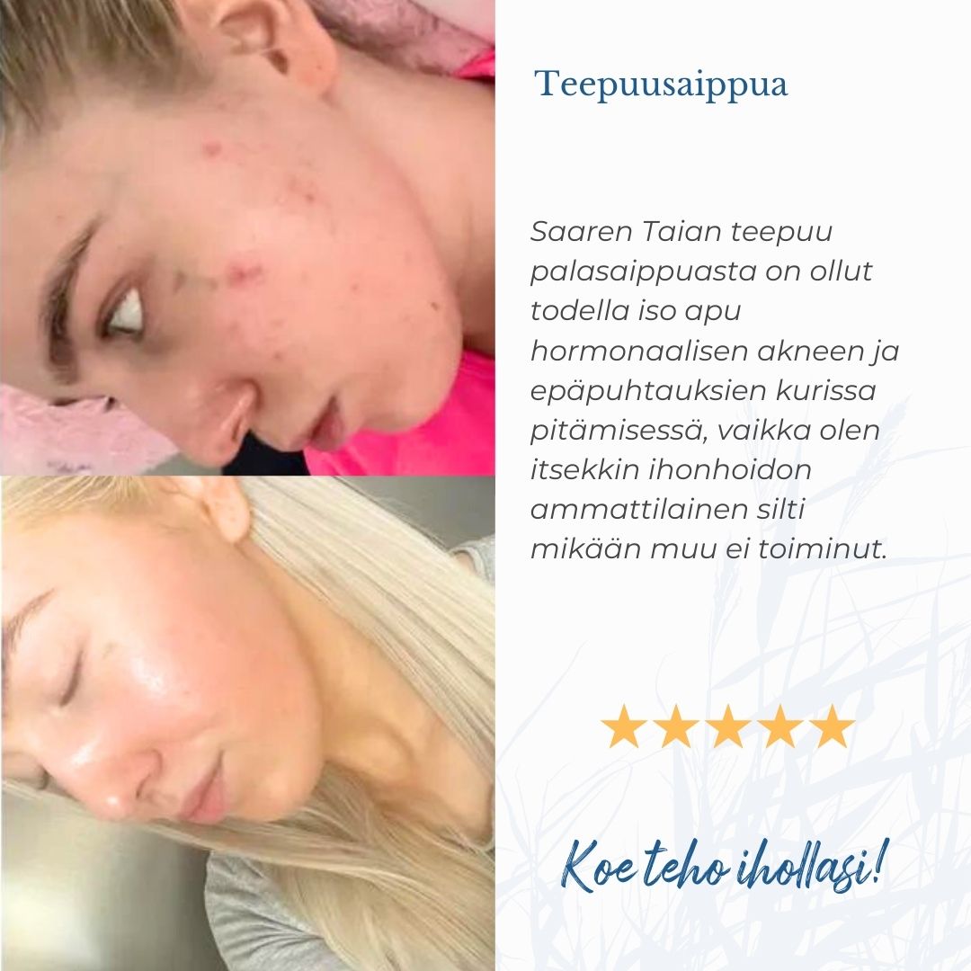 Saaren Taian teepuu palasaippuasta on ollut todella iso apu hormonaalisen akneen ja epäpuhtauksien kurissa pitämisessä, vaikka olen itsekkin ihonhoidon ammattilainen silti mikään muu ei toiminut.