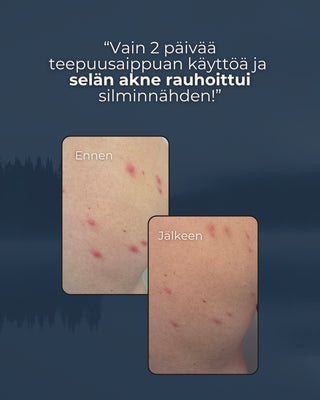 Nestemäinen Teepuusaippua pumppupullossa, akneiholle, kaikille ihotyypeille, sulfaatiton