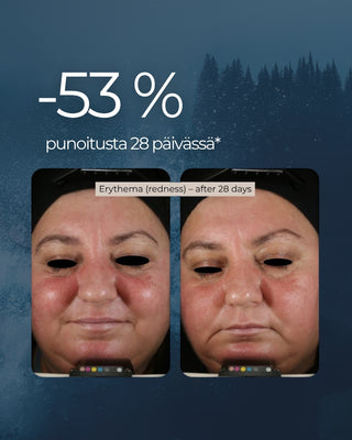 Blåstångs superserum, peptider, retinol, hyaluronsyra, leverfläckar, rynkor, porer