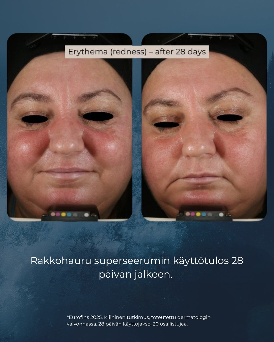 Bladderwrack super serum, peptides, retinol, hyaluronic acid, liver spots, wrinkles, pores