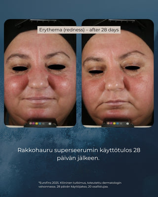 Rakkohauru superseerumi, peptidit, retinoli, hyaluronihappo, maksaläiskät, juonteet, ihohuokoset